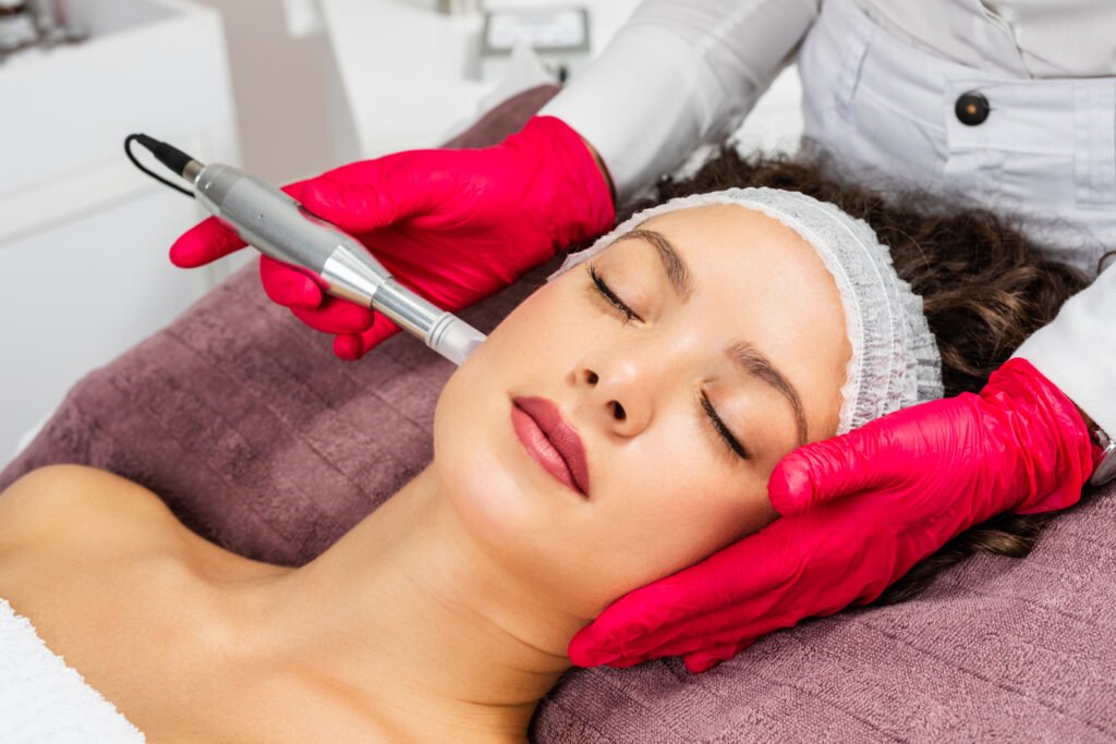agnes microneedling lower face treatment